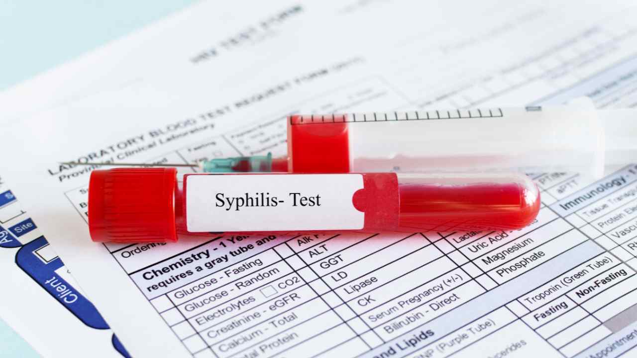 sifilide cura farmacologica