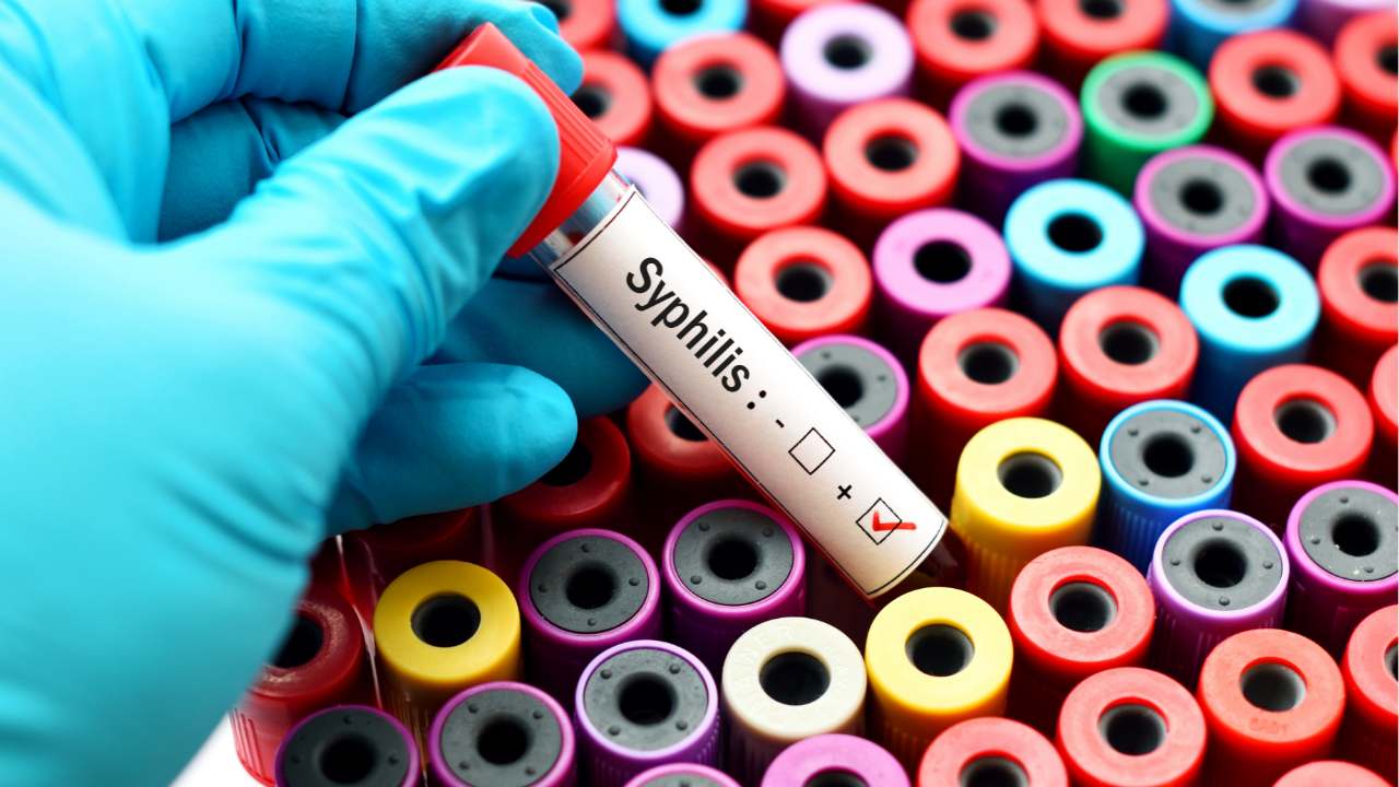 come curare sifilide