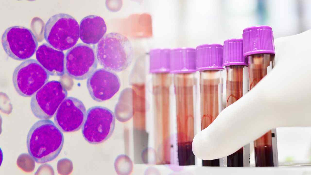 covid leucemia test