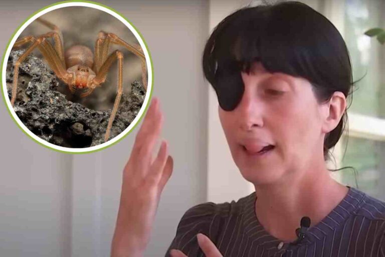 Allarme ragno violino, le conseguenze sono tremende