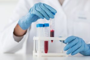 scienziato con provette con sangue