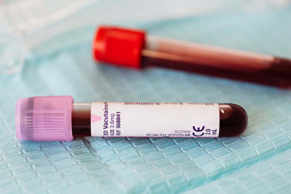 provette con sangue