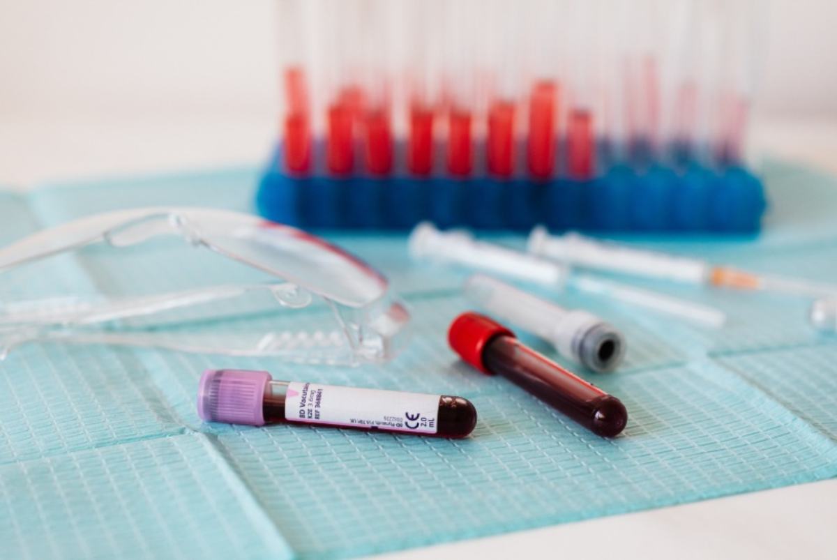 Provette per analisi del sangue