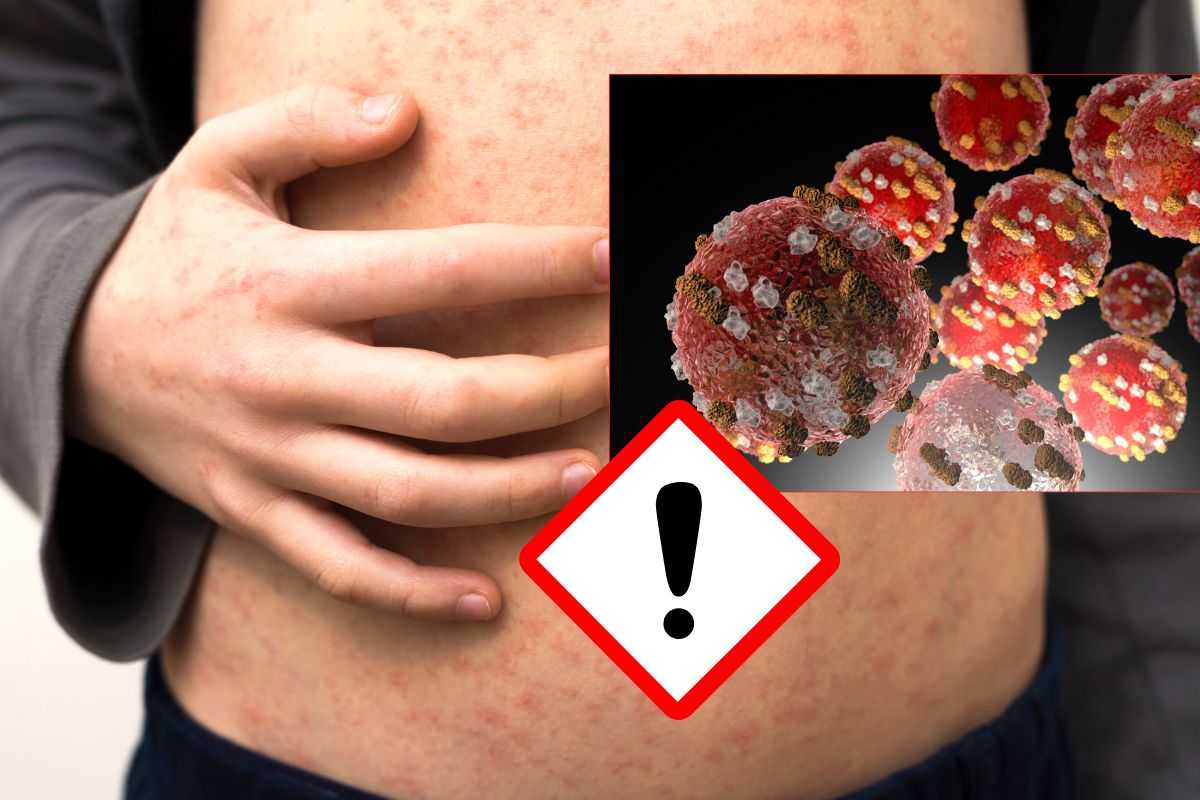 Corpo pieno di bollicine rosse