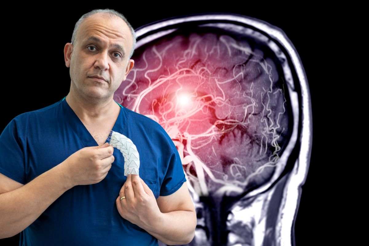 Medico spiega cos'è un aneurisma