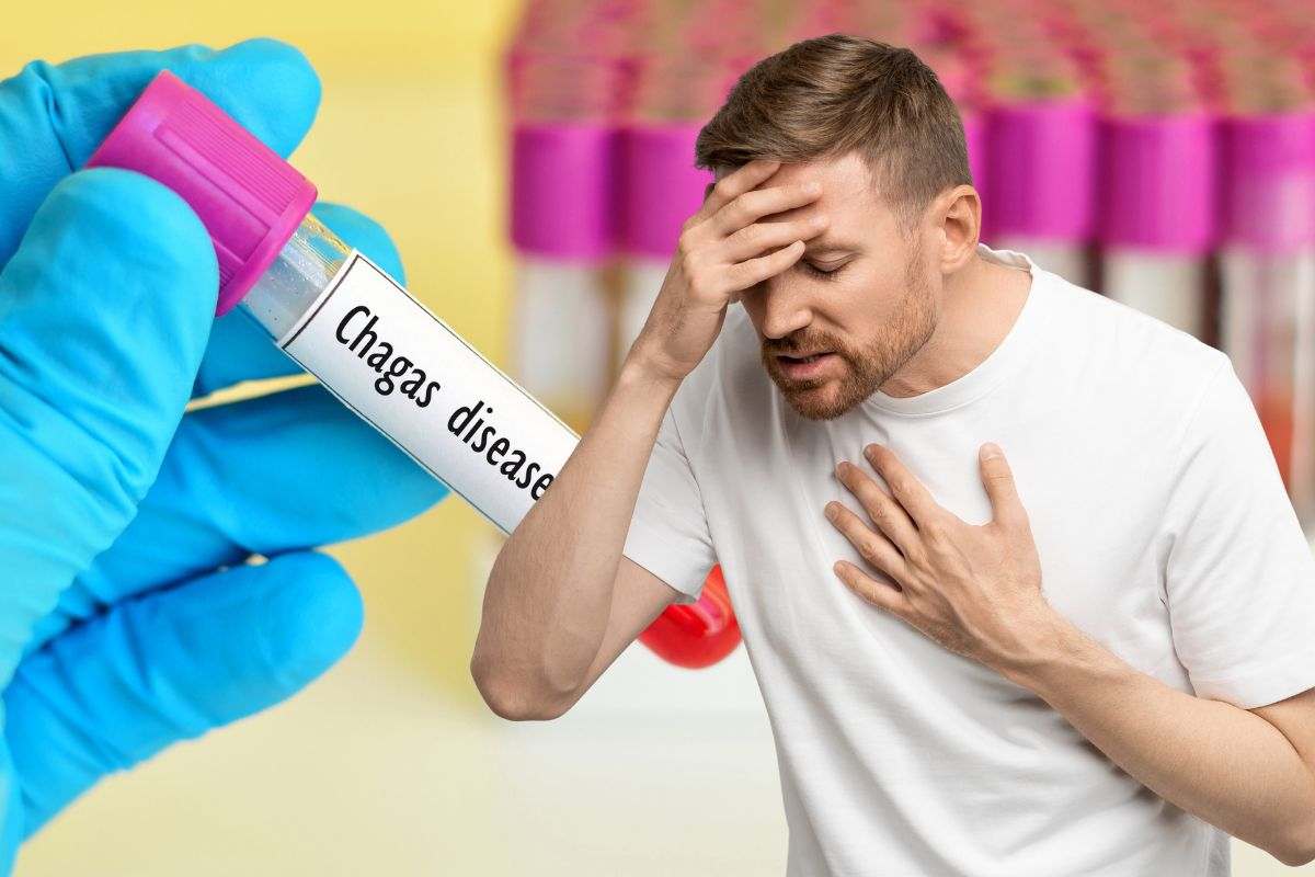 Infezione Chagas per colpa di una cimice
