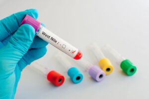 Una provetta contenente il virus West Nile