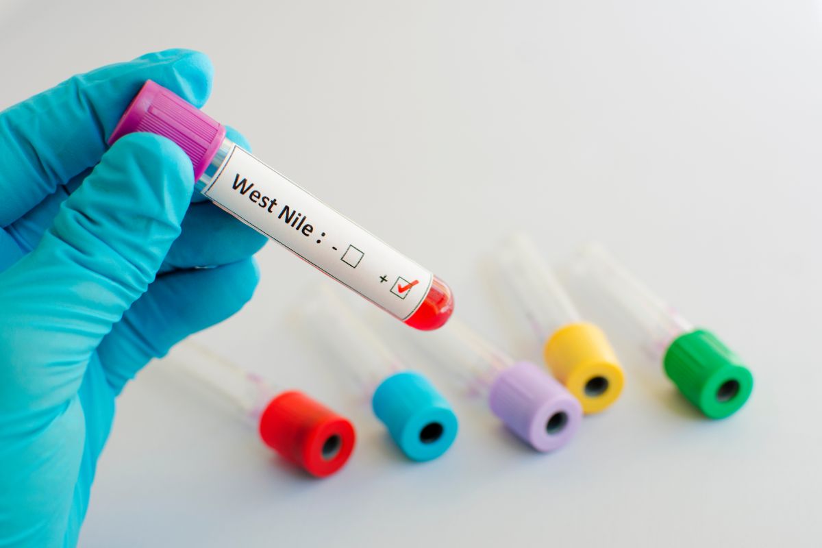 Una provetta contenente il virus West Nile