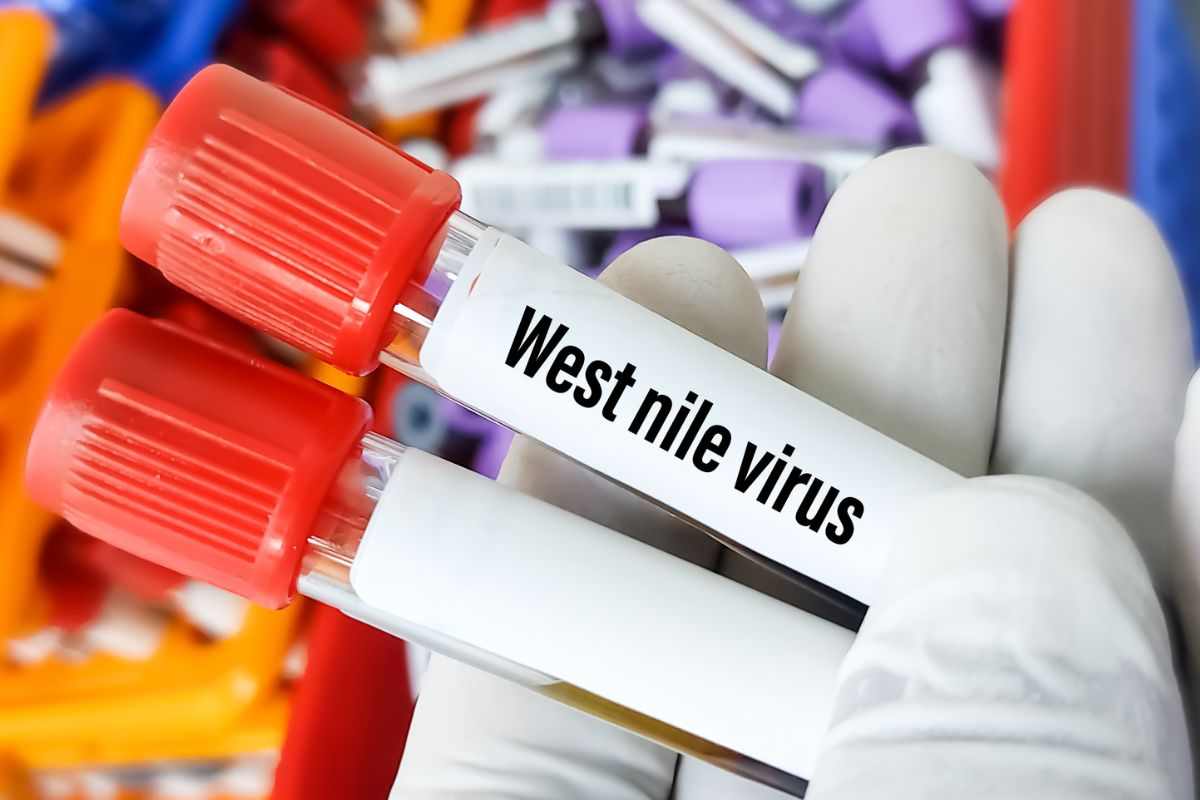 provette sangue west nile