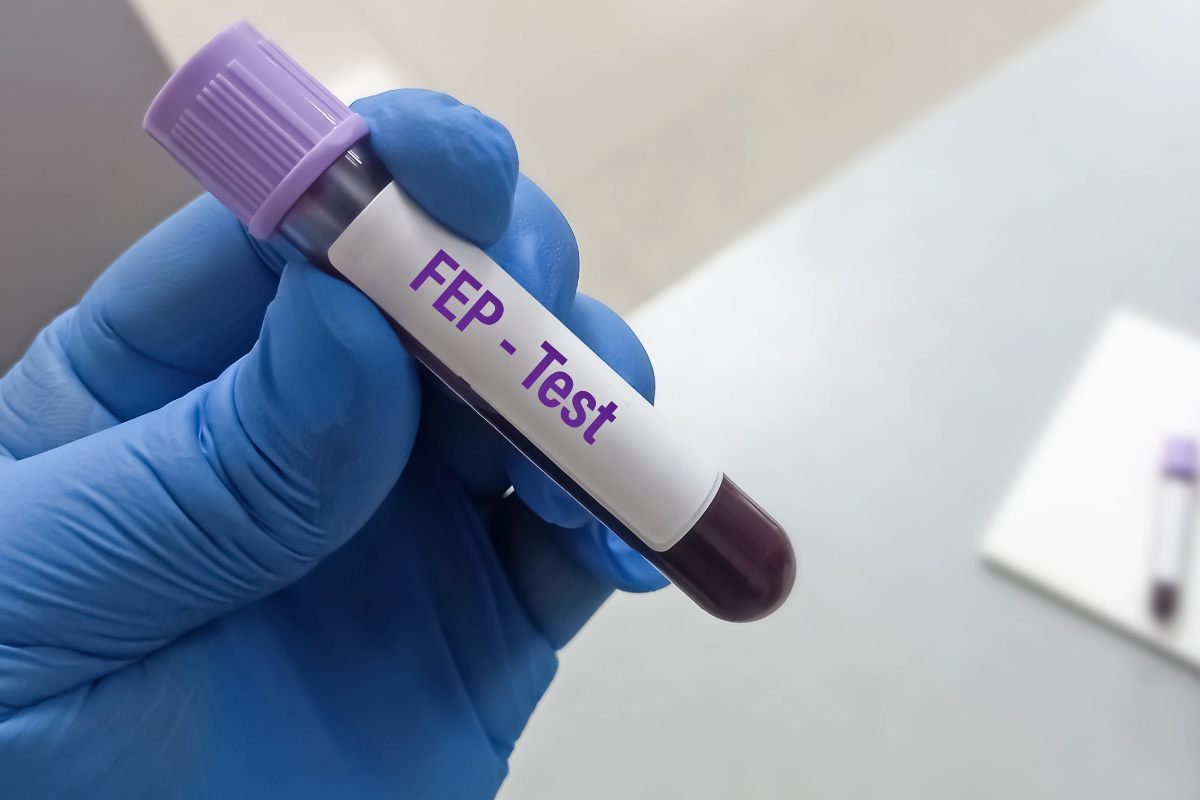 Provetta piena di sangue