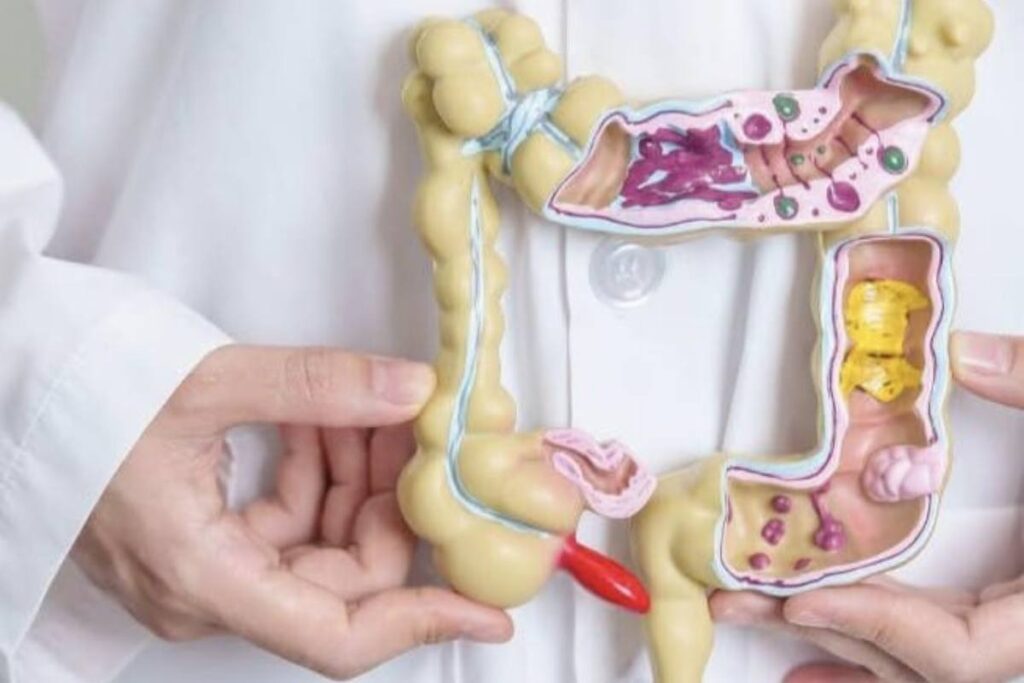 Tumore colon retto nuovo bersaglio