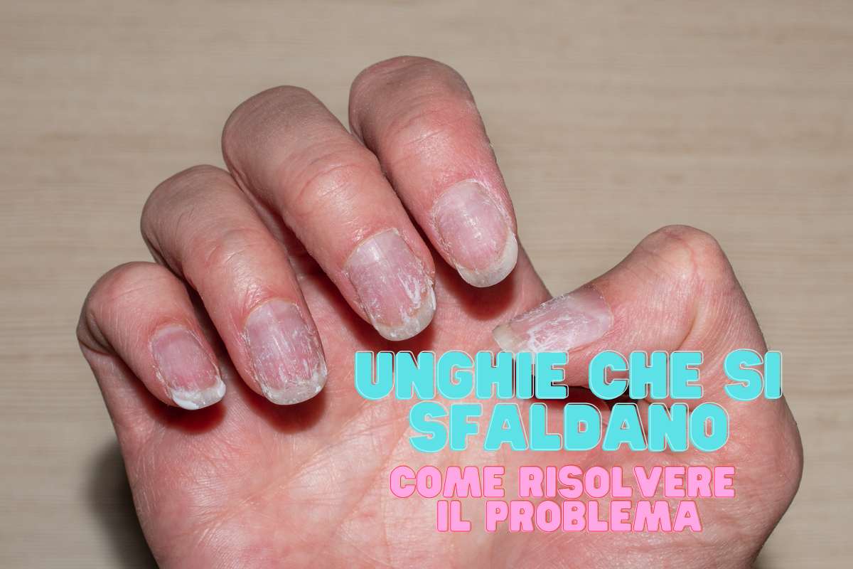 Unghie che si sfaldano come risolvere problema