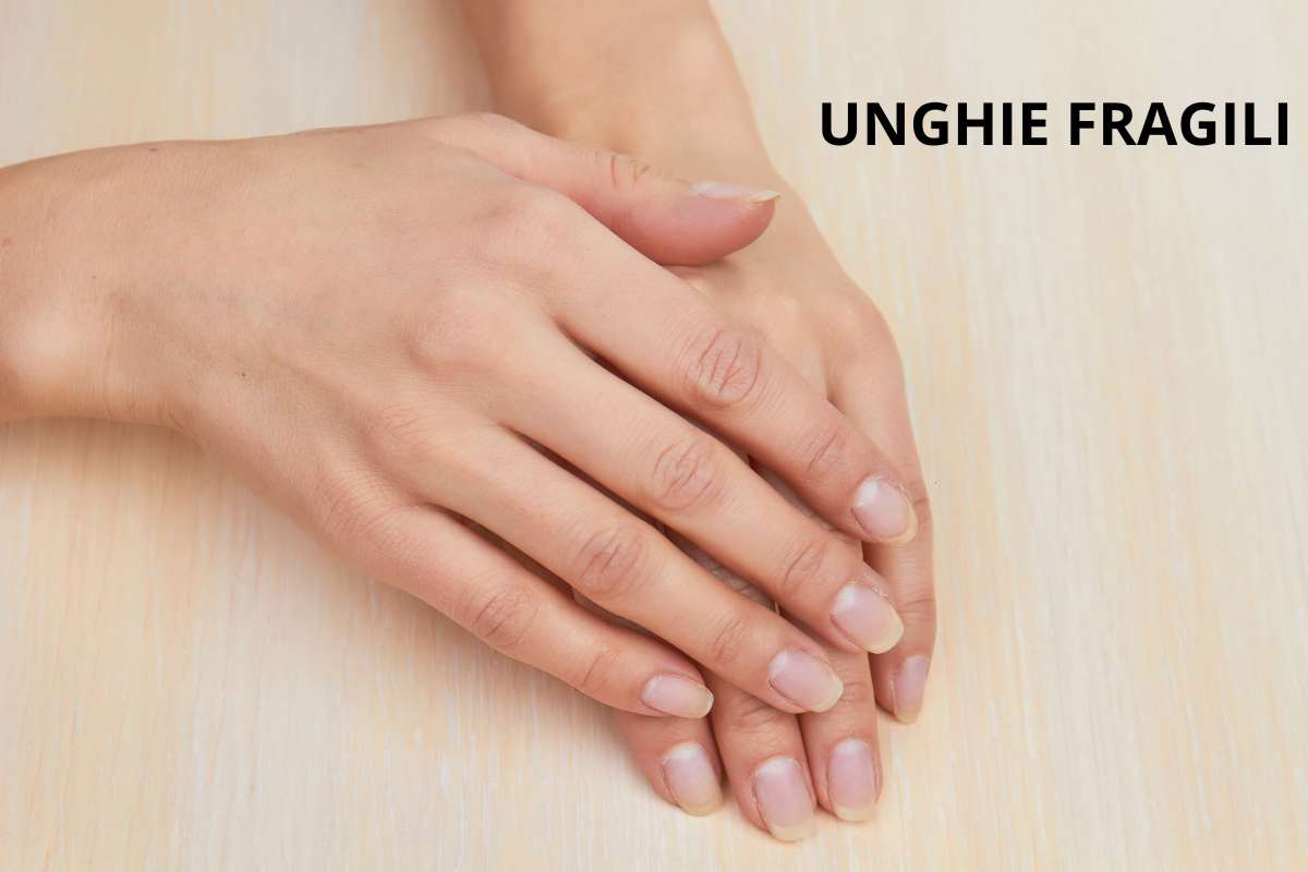 Unghie che si sfaldano come risolvere problema