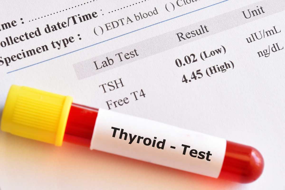 provetta sangue etichetta test tiroide