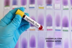 Legionella cosa c'è da sapere