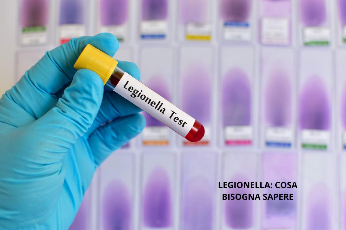 Legionella cosa c'è da sapere